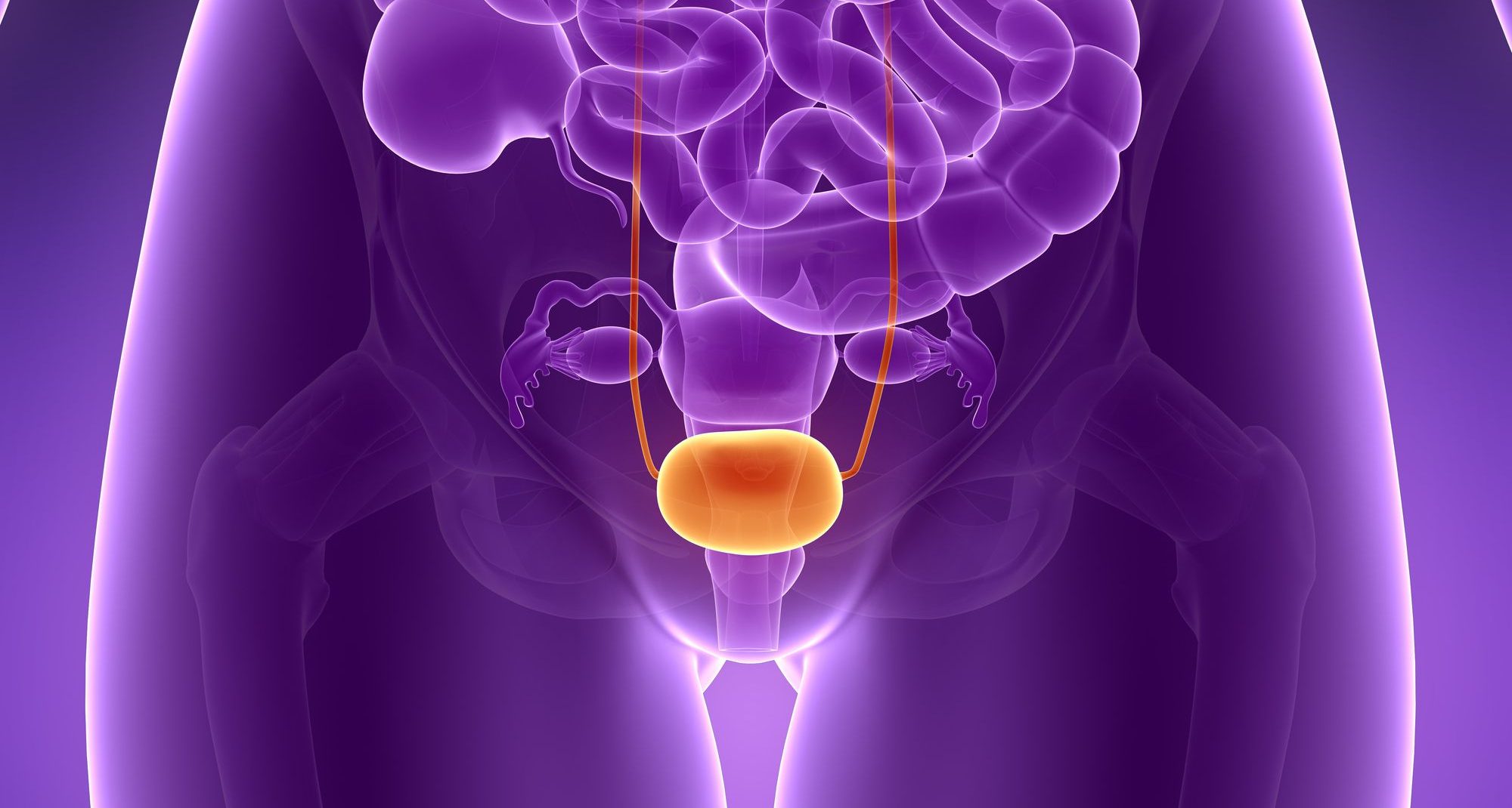 63. Cancerul vezicii urinare